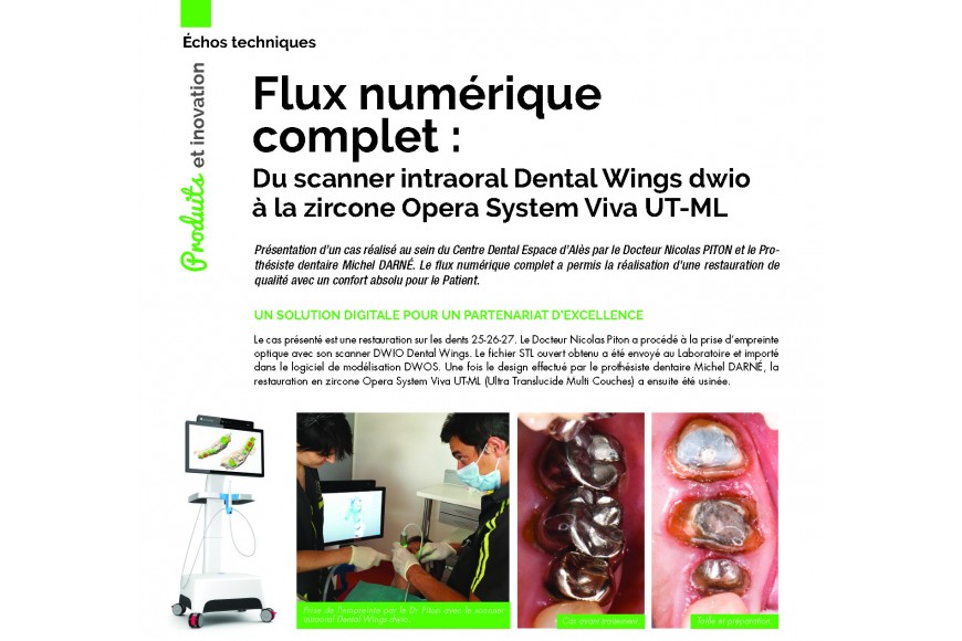 Flux numérique complet : du scanner intraoral Dental Wings dwio à la zircone Opera System UT-ML