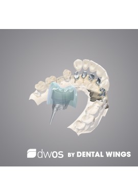 COURONNE & BRIDGE - DWOS by Dental Wings