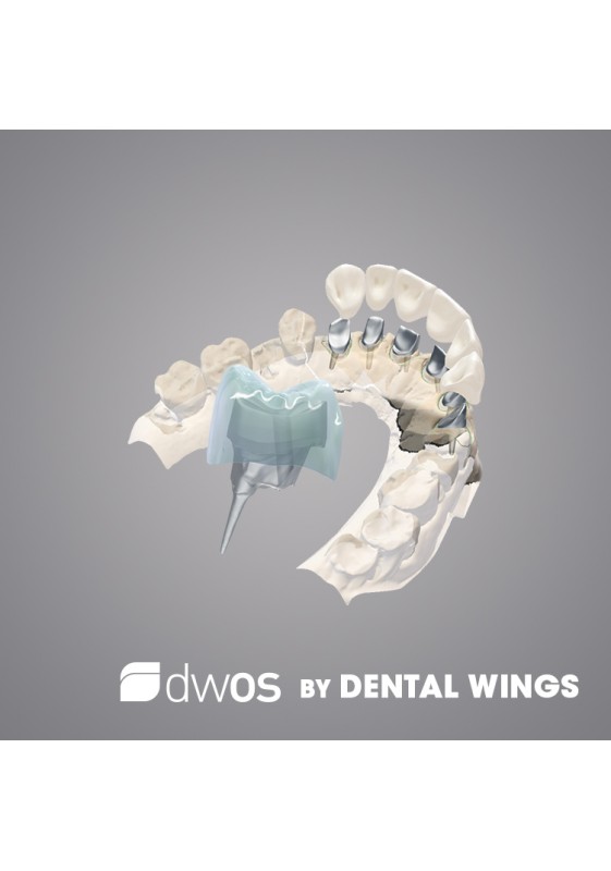 MODULE COURONNE ET BRIDGE - DWOS