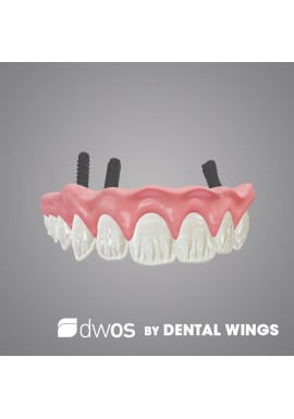GESTION DE L’IMPLANT - DWOS by Dental Wings