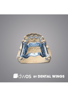 PROTHESE PARTIELLE AMOVIBLE - DWOS by Dental Wings