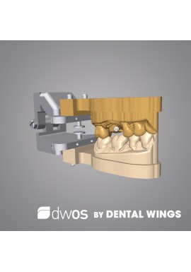 MODELE VIRTUEL - DWOS by Dental Wings