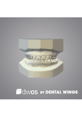 ARCHIVAGE ORTHODONTIE - DWOS by Dental Wings
