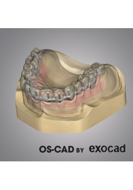 BARRE - OS-CAD BY EXOCAD