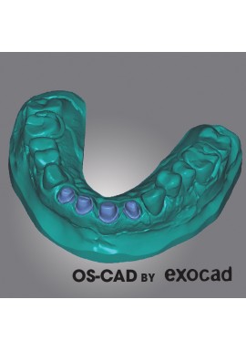 MODEL CREATOR - OS-CAD BY EXOCAD