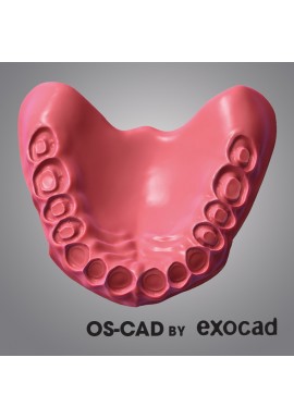 PROTHESE PARTIELLE - OS-CAD BY EXOCAD