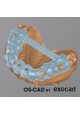 CHIRURGIE GUIDEE - OS-CAD  BY EXOCAD