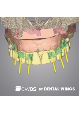 coDiagnostiX - DWOS by Dental Wings