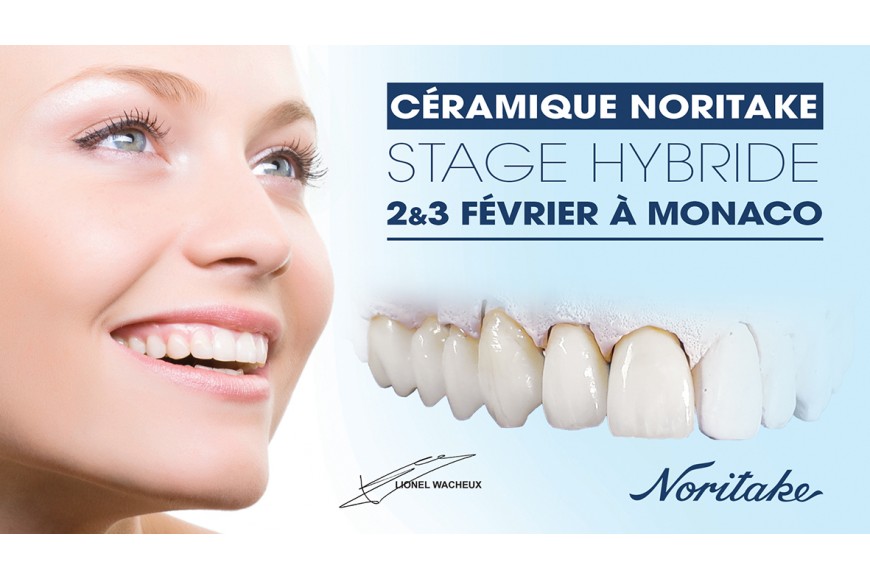 Céramique Noritake - Stage Hybride