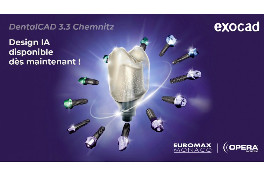 Découvrez exocad DentalCAD 3.3 Chemnitz - Nouvelle mise-à-jour disponible !
