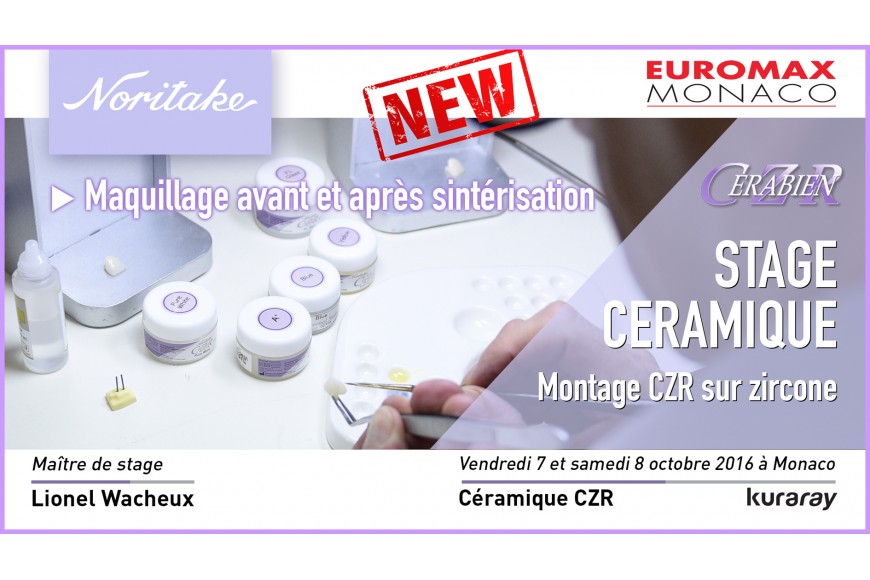 Stage céramique Noritake - Montage CZR sur zircone